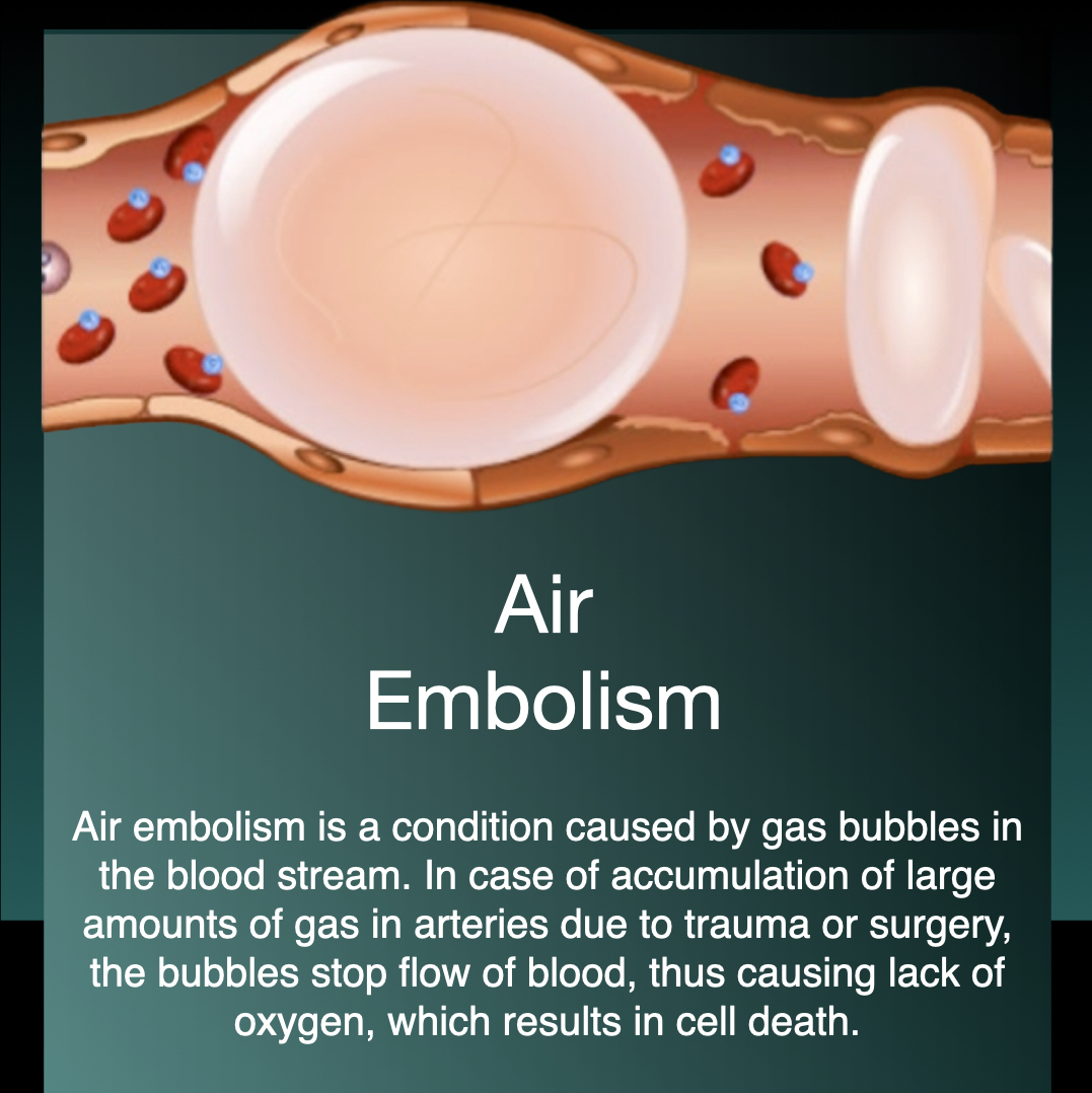 Air Embolism